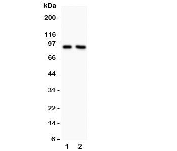 Western blot testing of NHE1 antibody and Lane 1: rat PC12; 2: human MCF-7. Predicted/observed size ~91KD