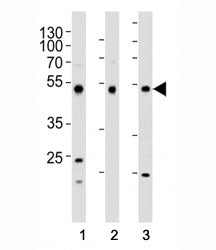 Western blot analysis of lysate from (1) HepG2, (2) HT-29, and (3) SW620 cell line using FOXA2 antibody at 1:1000. Predicted molecular weight: 50 kDa.