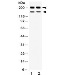 Western blot testing of 1) rat thymus and 2) human placenta lysate with WRN antibody at 0.5ug/ml. Observed molecular weight: ~162 and 200 kDa.