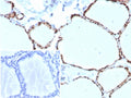IHC staining of FFPE human thyroid tissue with PAX8 antibody (clone PAX8/8973R). HIER: boil tissue sections in pH 9 10mM Tris with 1mM EDTA for 20 min and allow to cool before testing.