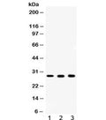 Western blot testing of 1) rat ovary, 2) mouse liver and 3) human MCF7 lysate with CA2 antibody at 0.5ug/m. Predicted/observed molecular weight ~29 kDa.