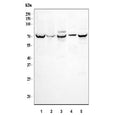 Western blot testing of 1) human HepG2, 2) human 293T, 3) rat kidney, 4) rat NRK and 5) mouse kidney tissue lysate with SGLT1 antibody. Expected molecular weight: ~73 kDa.
