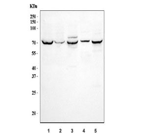 Western blot testing of 1) human HepG2, 2) human 293T, 3) rat kidney, 4) rat NRK and 5) mouse kidney tissue lysate with SGLT1 antibody. Expected molecular weight: ~73 kDa.