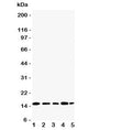 Western blot testing of TIA-1 antibody and Lane 1: Jurkat; 2: Raji; 3: CEM; 4: HT1080; 5: K562 cell lysate. Predicted molecular weight: ~43kDa and ~15kDa (granulocyte-associated isoform).