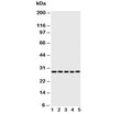 Western blot testing of Caspase-14 antibody; Lane 1: rat brain; 2: rat liver; 3: rat spleen; 4: human A431; 5: mouse NIH3T3