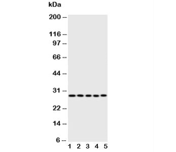Western blot testing of Caspase-14 antibody; Lane 1: rat brain; 2: rat liver; 3: rat spleen; 4: human A431; 5: mouse NIH3T3