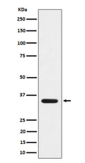Western blot analysis of DEGS1 expression in human 293 cell lysate using DEGS1 antibody. Predicted molecular weight ~38 kDa.