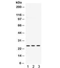 Western blot testing of 1) rat brain, 2) mouse brain and 3) human U87 lysate with PGP 9.5 antibody. Expected/observed molecular weight ~25 kDa.