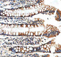 Immunohistochemical staining of NUDT8 using anti-NUDT8 antibody. NUDT8 was detected in a paraffin-embedded section of human prostatic hyperplasia tissue. Heat mediated antigen retrieval was performed in EDTA buffer (pH 8.0, epitope retrieval solution). The tissue section was blocked with 10% goat serum. The tissue section was then incubated with 2 ug/ml rabbit anti-NUDT8 antibody overnight at 4oC. Peroxidase Conjugated Goat Anti-rabbit IgG was used as secondary antibody and incubated for 30 min at 37oC.