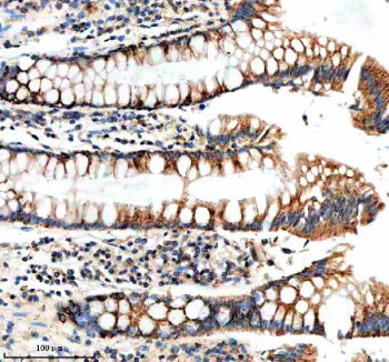 Immunohistochemical staining of NUDT8 using anti-NUDT8 antibody. NUDT8 was detected in a paraffin-embedded section of human prostatic hyperplasia tissue. Heat mediated antigen retrieval was performed in EDTA buffer (pH 8.0, epitope retrieval solution). The tissue section was blocked with 10% goat serum. The tissue section was then incubated with 2 ug/ml rabbit anti-NUDT8 antibody overnight at 4oC. Peroxidase Conjugated Goat Anti-rabbit IgG was used as secondary antibody and incubated for 30 min at 37oC.