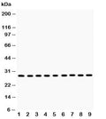Western blot testing of PRDX3 antibody and Lane 1: rat brain; 2: mouse brain; 3: rat skeletal muscle; 4: mouse skeletal muscle; 5: human U-2 0S; 6: HeLa; 7: SMMC-7721; 8: RH35; 9: A549 lysate. Expected molecular weight: ~28 kDa.