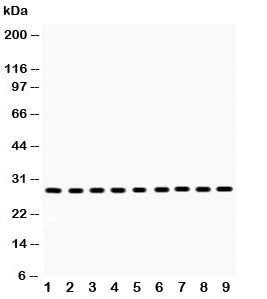 Western blot testing of PRDX3 antibody and Lane 1: rat brain; 2: mouse brain; 3: rat skeletal muscle; 4: mouse skeletal muscle; 5: human U-2 0S; 6: HeLa; 7: SMMC-7721; 8: RH35; 9: A549 lysate. Expected molecular weight: ~28 kDa.