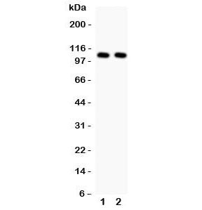 Western blot testing of NFKB1 antibody and 1. HeLa and 2. Jurkat cell lysate. Expected molecular weight: 50 kDa / 105 kDa.
