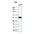 Western blot testing of human brain tissue with GFAP antibody (clone GFAP/9423). Predicted molecular weight ~50 kDa.