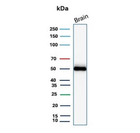 Western blot testing of human brain tissue with GFAP antibody (clone GFAP/9423). Predicted molecular weight ~50 kDa.