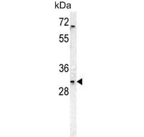 Western blot testing of human HEK293 cell lysate with DcR3 antibody. Predicted molecular weight ~33 kDa.