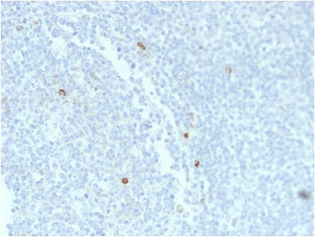 IHC staining of FFPE human tonsil tissue with recombinant IgM Heavy Chain antibody (clone rIM373). HIER: boil tissue sections in pH6, 10mM citrate buffer, for 10-20 min and allow to cool before testing.