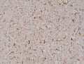 IHC staining of FFPE human liver tissue with recombinant Caveolin-1 antibody at 1:1000.