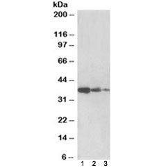 Western blot testing of human liver lysate [lane 1], mouse liver [lane 2] and rat liver [lane 3] with PP2A antibody at 0.5ug/ml. Expected molecular weight: 37/41/33/32 kDa (alpha/beta/delta/epsilon isoforms).