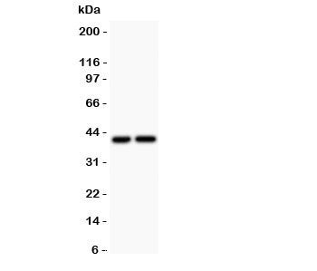 Western blot testing of CXCR3 antibody and Lane 1: COLO320; 2: SGC lysate. Predicted molecular weight ~41 kDa.