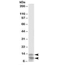 Western blot testing of K562 lysate with DPM3 antibody at 2ug/ml. Predicted molecular weight: ~10/13kDa (short/long isoform).