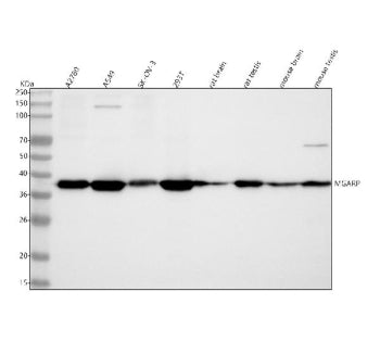 Western blot analysis of C4orf49/MGARP using anti-MGARP antibody. Lane 1: human whole cell lysates, Lane 2: human whole cell lysates, Lane 3: human SK-OV-3 whole cell lysates, Lane 4: human 293T whole cell lysates, Lane 5: rat brain tissue lysates, Lane 6: rat testis tissue lysates, Lane 7: mouse brain tissue lysates, Lane 8: mouse testis tissue lysates. After electrophoresis, proteins were transferred to a nitrocellulose membrane at 150 mA for 50-90 min.