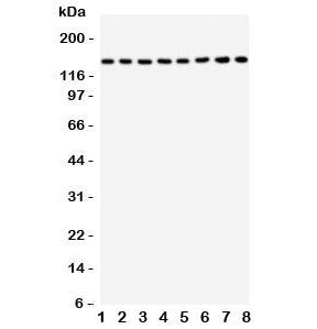 Western blot testing of TSC1 antbody and rat samples: 1. skeletal muscle; 2. heart; 3. brain; 4. lung; and human samples: 5. 293T; 6. HeLa; 7. HT1080; 8. SMMC-7721. Expected/observed molecular weight: 130~150 kDa.