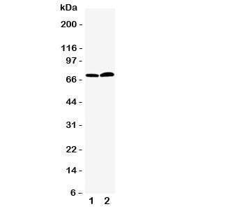 Western blot testing of PAD4 antbody; Lane 1: PANC; 2: 293T cell lysate. Predicted/observed size ~72KD