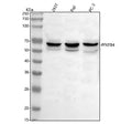 Western blot analysis of PFKFB4 using anti-PFKFB4 antibody. Lane 1: human 293T whole cell lysates, Lane 2: human Raji whole cell lysates, Lane 3: human PC-3 whole cell lysates. After electrophoresis, proteins were transferred to a nitrocellulose membrane at 150 mA for 50-90 min. Blocked the membrane with 5% non-fat milk/TBS for 1.5 hour at RT.
