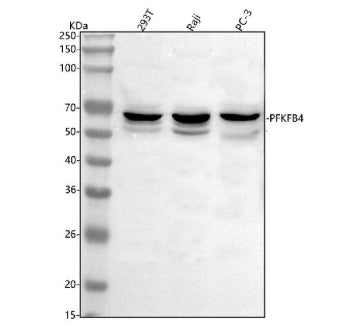 Western blot analysis of PFKFB4 using anti-PFKFB4 antibody. Lane 1: human 293T whole cell lysates, Lane 2: human Raji whole cell lysates, Lane 3: human PC-3 whole cell lysates. After electrophoresis, proteins were transferred to a nitrocellulose membrane at 150 mA for 50-90 min. Blocked the membrane with 5% non-fat milk/TBS for 1.5 hour at RT.