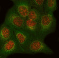 Immunofluorescent staining of FFPE human U-2 OS cells with ONECUT1 antibody (red) and Beta Tubulin mAb (green). HIER: steam section in pH6 citrate buffer for 20 min.