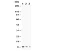 Western blot testing of TGF alpha antibody and Lane 1: recombinant human protein 10ng; 2: 5ng; 3: 2.5ng