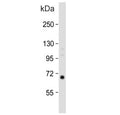 Western blot testing of human spleen tissue lysate with CalDAG-GEFI antibody. Predicted molecular weight ~69 kDa.