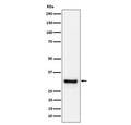 Western blot testing of human plasma cell lysate with ADIPOQ antibody. Predicted molecular weight ~30 kDa.