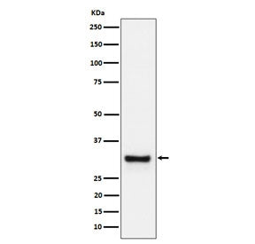 Western blot testing of human plasma cell lysate with ADIPOQ antibody. Predicted molecular weight ~30 kDa.