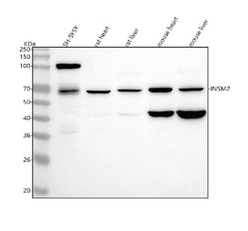 Western blot analysis of INSM2 using anti-INSM2 antibody. Lane 1: human SH-SY5Y whole cell lysates, Lane 2: rat heart tissue lysates, Lane 3: rat liver tissue lysates, Lane 4: mouse heart tissue lysates, Lane 5: mouse liver tissue lysates. After electrophoresis, proteins were transferred to a nitrocellulose membrane at 150 mA for 50-90 min. Blocked the membrane with 5% non-fat milk/TBS for 1.5 hour at RT.