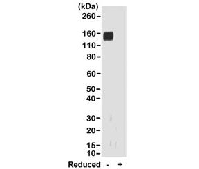 Western blot of nonreduced(-) and reduced(+) rabbit IgG (20ng/lane), using 0.2ug/ml of recombinant Rabbit IgG Fab antibody. This antibody reacts to nonreduced rabbit IgG (~150 kDa).