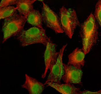 Immunofluorescent staining of PARG using anti-PARG antibody (green) and anti-Beta Tubulin antibody (red). PARG was detected in an immunocytochemical section of cells. Enzyme antigen retrieval was performed using IHC enzyme antigen retrieval reagent for 15 mins. The cells were blocked with 10% goat serum. And then incubated with 5 ug/ml rabbit anti-PARG antibody and mouse anti-Beta Tubulin antibody overnight at 4oC.