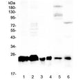 Western blot testing of human 1) A431, 2) K562, 3) U-2 OS, 4) HL60, 5) rat liver and 6) mouse kidney lysate with MED18 antibody at 0.5ug/ml. Predicted molecular weight ~24 kDa.