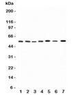 Western blot testing of Kv1.1 antibody and Lane 1: rat brain; 2: (r) testis; 3: (r) heart; 4: human HeLa; 5: (h) U87; 6: (h) SHG-44; 7: mouse Neuro-2a lysate. Expected molecular weight: 56-85 kDa depending on glycosylation level.
