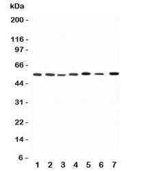 Western blot testing of Kv1.1 antibody and Lane 1: rat brain; 2: (r) testis; 3: (r) heart; 4: human HeLa; 5: (h) U87; 6: (h) SHG-44; 7: mouse Neuro-2a lysate. Expected molecular weight: 56-85 kDa depending on glycosylation level.