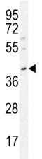 Oct3/4 antibody western blot analysis in MDA-MB231 lysate. Predicted molecular weight ~38/30kDa (isoform A/B).