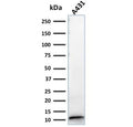 Western blot testing of human A431 lysate with S100A2 antibody. Expected molecular weight ~11 kDa.