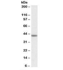 Western blot testing of human testis lysate with TAF7L antibody at 1ug/ml. Predicted molecular weight: ~52/43/35kDa (isoforms 1/2/3).