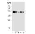 Western blot testing of human 1) HL60, 2) CCRF-CEM, 3) SH-SY5Y, 4) MOLT4 and 5) mouse Neuro-2a cell lysate with Bleomycin hydrolase antibody. Predicted molecular weight ~53 kDa.