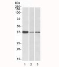 Western blot testing of human 1) liver, 2) skin and 3) tonsil lysate with IL12B antibody at 0.3ug/ml. Predicted molecular weight: 37~40 kDa.