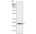Western blot testing of human fetal kidney lysate with Prealbumin antibody. Predicted molecular weight ~16 kDa.