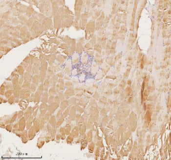 Immunohistochemical staining of MAP4K3 using anti-MAP4K3 antibody. MAP4K3 was detected in a paraffin-embedded section of human skeletal muscle tissue. Heat mediated antigen retrieval was performed in EDTA buffer (pH 8.0, epitope retrieval solution). The tissue section was blocked with 10% goat serum. The tissue section was then incubated with 2 ug/ml rabbit anti-MAP4K3 antibody overnight at 4oC. Peroxidase Conjugated Goat Anti-rabbit IgG was used as secondary antibody and incubated for 30 min at 37oC.