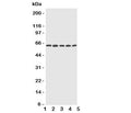 Western blot testing of CYP2U1 antibody and Lane 1: HeLa; 2: MCF-7; 3: MM453; 4: COLO320; 5: HT1080 cell lysate