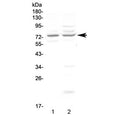 Western blot testing of human 1) COLO320 and 2) U-87 MG cell lysate with CHM antibody at 0.5ug/ml. Predicted molecular weight ~73 kDa.